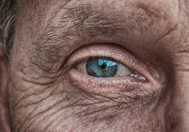PÉRDIDA DE VISIÓN EN LOS ANCIANOS 23arrugas