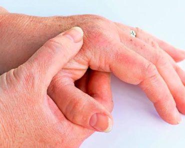 CUIDADOS DERMATOLÓGICOS EN LOS ADULTOS MAYORES