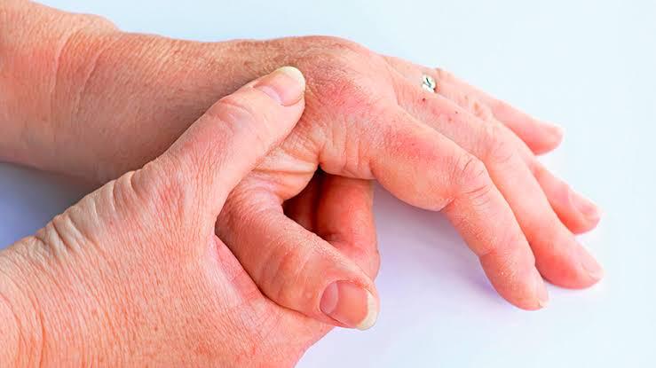 CUIDADOS DERMATOLÓGICOS EN LOS ADULTOS MAYORES 11arrugas